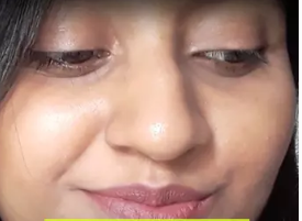 After Carbon Facial