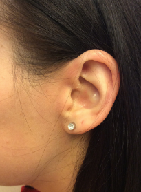 After Dermatitis Treatment