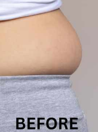 Before Fat Melting