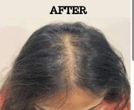 After Hair GFC
