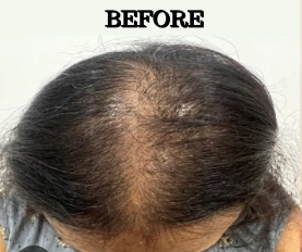 Before Hair GFC