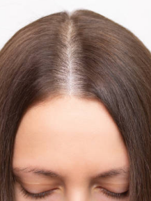 Hair Fall Information